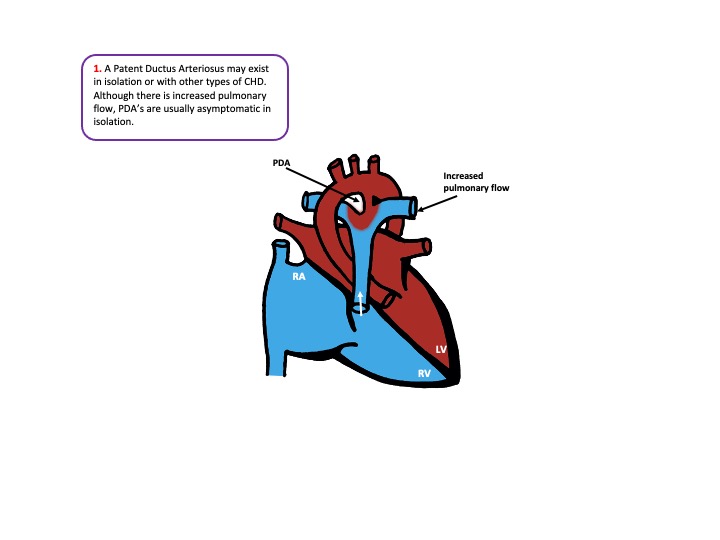 congenital heart